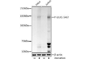 Western blot analysis of extracts of various cell lines, using Phospho-ULK1-S467 antibody (ABIN7271218) at 1:1000 dilution.