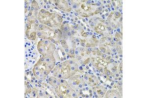 Immunohistochemistry of paraffin-embedded rat kidney using ACO1 antibody (ABIN5995389) at dilution of 1/100 (40x lens). (Aconitase 1 anticorps)