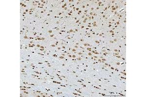 IHC analysis of THAP11 using anti-THAP11 antibody (ABIN7599230). (THAP11 anticorps  (AA 1-294))