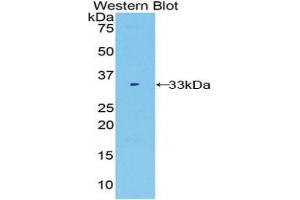 Western blot analysis of the recombinant protein. (FUCA1 anticorps  (AA 170-420))