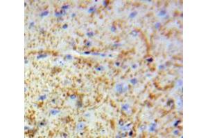 IHC-P analysis of Brain tissue, with DAB staining. (MBP anticorps  (AA 220-301))