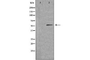 Western blot analysis of extracts from COLO205 cells, using TIGD3 antibody.