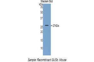 Detection of Recombinant GUSb, Mouse using Polyclonal Antibody to Glucuronidase Beta (GUSb)