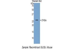 Detection of Recombinant GUSb, Mouse using Polyclonal Antibody to Glucuronidase Beta (GUSb) (Glucuronidase beta anticorps  (AA 451-648))