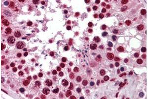 Human Testis: Formalin-Fixed, Paraffin-Embedded (FFPE)