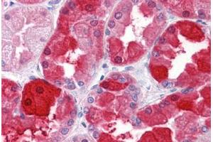 Human Kidney: Formalin-Fixed, Paraffin-Embedded (FFPE) (CRYM anticorps  (AA 215-315))