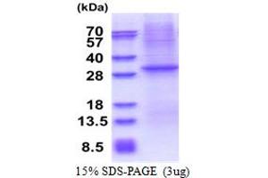SDS-PAGE (SDS) image for CD1e (CD1e) (AA 32-305) protein (His tag) (ABIN5853610)