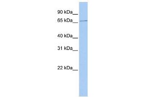 WB Suggested Anti-SCMH1 Antibody Titration: 0. (SCMH1 anticorps  (Middle Region))