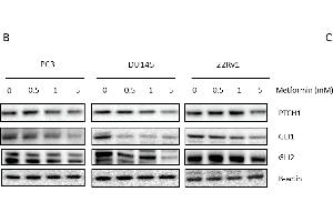 Link between metformin and Hedgehog signaling. (GLI2 anticorps  (AA 30-65))