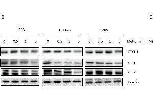 Link between metformin and Hedgehog signaling. (GLI2 anticorps  (Internal Region))