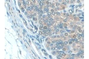 Detection of IL22Ra2 in Mouse Stomach Tissue using Polyclonal Antibody to Interleukin 22 Receptor Alpha 2 (IL22Ra2) (IL22RA2 anticorps  (AA 31-223))