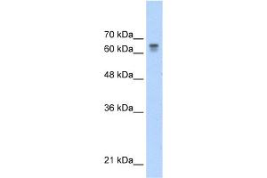 WB Suggested Anti-PAntibody Titration:  0. (PARP6 anticorps  (C-Term))
