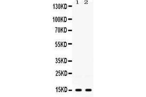 Western blot analysis of ISG15 expression in 22RV1 whole cell lysates ( Lane 1) and HELA whole cell lysates ( Lane 2). (ISG15 anticorps  (AA 2-157))