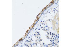 Immunohistochemistry of paraffin-embedded rat lung using ST3GAL3 antibody.