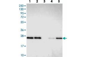 Western blot analysis of Lane 1: RT-4, Lane 2: U-251 MG, Lane 3: Human Plasma, Lane 4: Liver, Lane 5: Tonsil with GDF6 polyclonal antibody . (GDF6 anticorps)