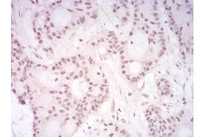 Immunohistochemical analysis of paraffin-embedded HeLa tissues using DDX39B mouse mAb with DAB staining. (DDX39B anticorps  (AA 1-250))