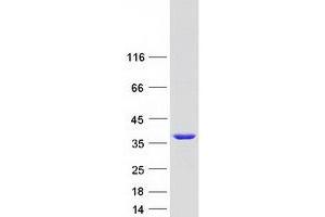Validation with Western Blot