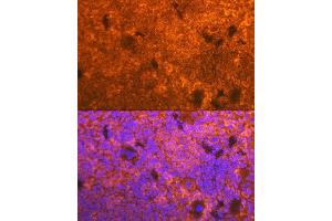 Immunofluorescence analysis of mouse spleen using CD3D Rabbit mAb (ABIN7266193) at dilution of 1:100 (40x lens). (CD3D anticorps)