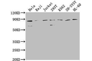 Western Blot Positive WB detected in: Hela whole cell lysate, Raji whole cell lysate, Jurkat whole cell lysate, 293T whole cell lysate, K562 whole cell lysate, SH-SY5Y whole cell lysate, HL-60 whole cell lysate All lanes: ZRANB1 antibody at 1:2000 Secondary Goat polyclonal to rabbit IgG at 1/50000 dilution Predicted band size: 81 kDa Observed band size: 81 kDa (ZRANB1 anticorps  (AA 111-397))