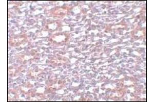 Immunohistochemistry of PIAS1 in rat kidney tissue with PIAS1 Antibody  at 5 μg/ml