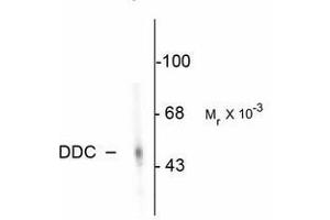 Image no. 2 for anti-Dopa Decarboxylase (Aromatic L-Amino Acid Decarboxylase) (DDC) antibody (ABIN220954) (DDC anticorps)