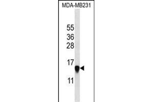 HIST2H2 Antibody (N-term) (ABIN657623 and ABIN2846619) western blot analysis in MDA-M cell line lysates (35 μg/lane). (HIST2H2AA3 anticorps  (N-Term))