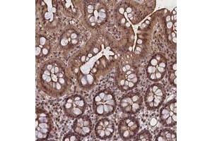 Immunohistochemical staining of human colon with FCHO1 polyclonal antibody  shows moderate cytoplasmic, nuclear and membranous positivity in glandular cells. (FCHO1 anticorps)