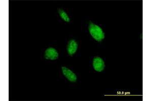 Immunofluorescence of purified MaxPab antibody to OVOL2 on HeLa cell. (OVOL2 anticorps  (AA 1-275))