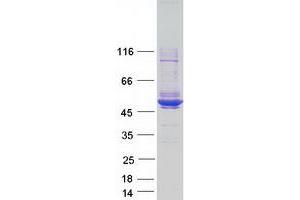 Validation with Western Blot