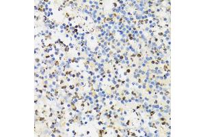 Immunohistochemistry of paraffin-embedded human appendicitis using SUMO4 Antibody (ABIN5971586) at dilution of 1/100 (40x lens). (SUMO4 anticorps)