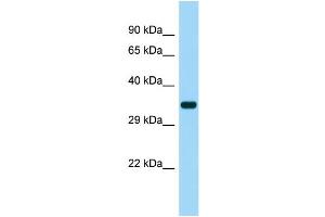 Host: Rabbit Target Name: SUCNR1 Sample Type: Fetal Heart lysates Antibody Dilution: 1. (SUCNR1 anticorps  (Middle Region))
