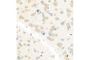 Immunohistochemistry analysis of paraffin embedded mouse brain using Erc2 (ABIN7073808) at dilution of 1: 3000 (ERC2 anticorps)