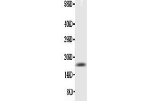 Western blot analysis of TNF alpha using anti- TNF alpha antibody . (TNF alpha anticorps  (AA 80-235))