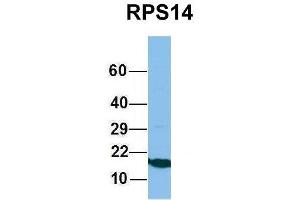 Host:  Rabbit  Target Name:  RPS14  Sample Type:  Jurkat  Antibody Dilution:  1.