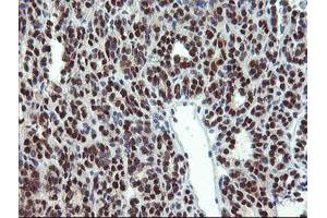 Image no. 1 for anti-Mannose Phosphate Isomerase (MPI) antibody (ABIN1499543)