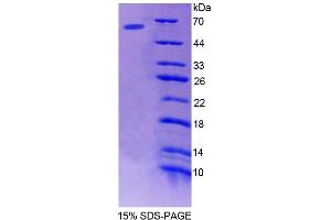 SDS-PAGE (SDS) image for Beta-secretase 1 (BACE1) (AA 170-428) protein (His tag,GST tag) (ABIN6236685) (BACE1 Protein (AA 170-428) (His tag,GST tag))