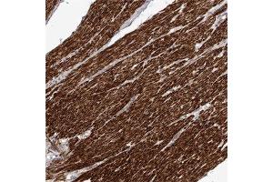 Immunohistochemical staining of human smooth muscle with FGFR4 polyclonal antibody  shows strong cytoplasmic positivity in smooth muscle cells at 1:50-1:200 dilution.