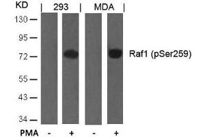 Western blot analysis of extracts from 293 and MDA cells untreated or treated with PMA using Raf1(Phospho-Ser259) Antibody. (RAF1 anticorps  (pSer259))