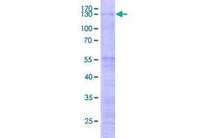 Image no. 1 for ZFP91 Zinc Finger Protein (ZFP91) (AA 1-569) protein (GST tag) (ABIN1990332)