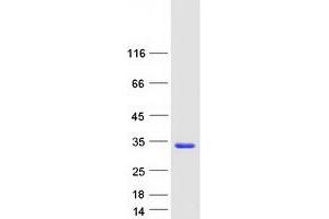 Validation with Western Blot