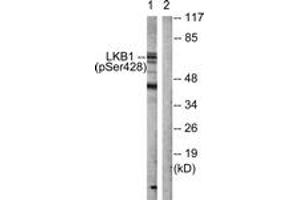 Western blot analysis of extracts from HeLa cells treated with PMA 125ng/ml 30', using LKB1 (Phospho-Ser428) Antibody. (LKB1 anticorps  (pSer428))