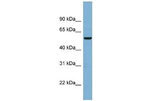 WB Suggested Anti-C2orf29 Antibody Titration: 0. (CNOT11 anticorps  (Middle Region))