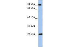 Image no. 1 for anti-Transmembrane Emp24-Like Trafficking Protein 10 (TMED10) (AA 143-192) antibody (ABIN6744308) (TMED10 anticorps  (AA 143-192))