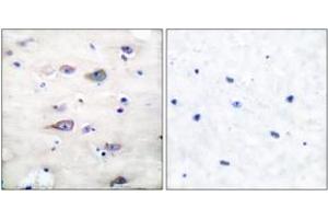 Immunohistochemistry (IHC) image for anti-Glutamate Receptor, Ionotropic, AMPA 2 (GRIA2) (pSer880) antibody (ABIN2888427) (GRIA2 anticorps  (pSer880))