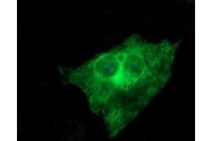Image no. 3 for anti-Tubulin, beta 2B (TUBB2B) antibody (ABIN1501573)