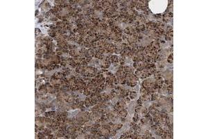 Immunohistochemical staining of human pancreas with CAMSAP1 polyclonal antibody  shows strong cytoplasmic positivity in exocrine glandular cells at 1:200-1:500 dilution.