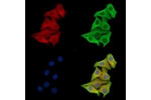 ABIN7097165 and ABIN7101233 staining Hela cells by IF/ICC. (XYLB anticorps)