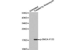 Western blot analysis of extracts from C2C12 cells, using Phospho-SNCA-Y133 antibody. (SNCA anticorps  (pTyr133))