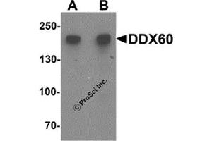 Western Blotting (WB) image for anti-DEAD (Asp-Glu-Ala-Asp) Box Polypeptide 60 (DDX60) antibody (ABIN1587945) (DDX60 anticorps)