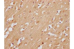 anti-Uncharacterized Protein SMIM29 (SMIM29) (AA 42-102) antibody